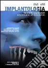 Implantologia. Tecniche implantari mininvasive e innovative Implantologia. Tecniche implantari mininvasive e innovative